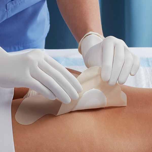 Kendall AMD Antimicrobial Gentle Border Foam Sacrum 19x19cm