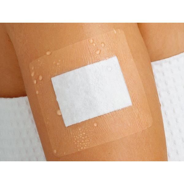 Curapor Transparent Wound Dressing 8cm x 10cm Box 25 - Image 2